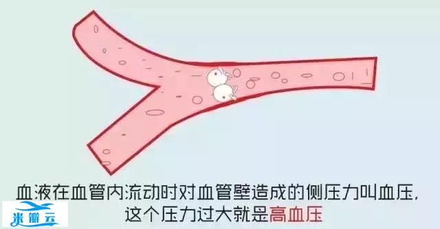 图解高血压，超级简易版！